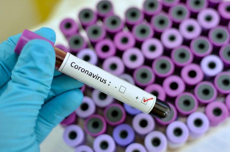 Laboratórios do Ministério da Agricultura serão usados para analisar testes do Coronavírus