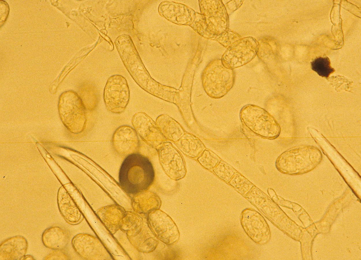 Foto:&nbsp;Gerald Holmes, Strawberry Center