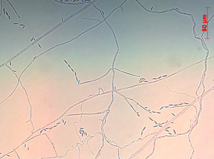 Imagem de microscopia de luz: hifas e microconídios de Fusarium verticillioides. – Foto: Renata Rebellato Linhares