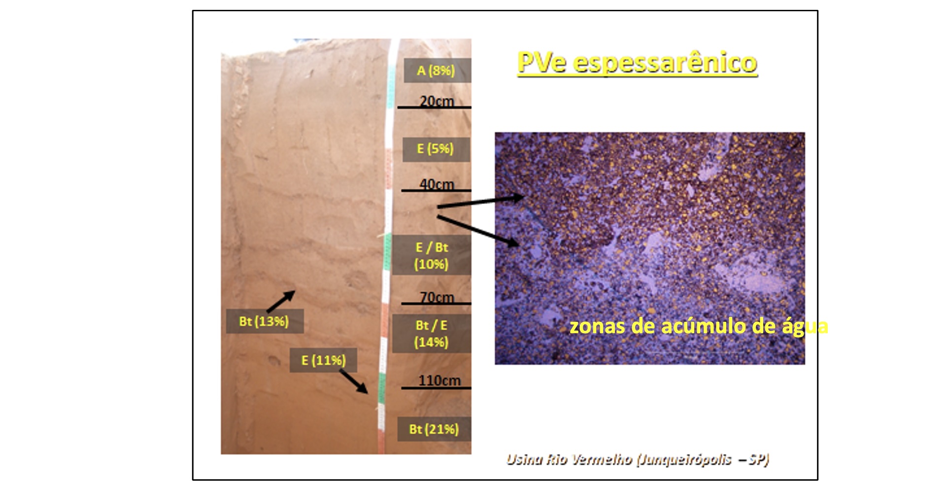 Perfil de um argissolo vermelho-amarelo eutrófico espessarênico, com detalhe micromorfológico mostrando o contato entre uma lamela de argila e a estrutura maciça porosa em grãos simples do horizonte E, provocando a formação de zonas de acúmulo de água&nbsp;&nbsp;