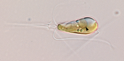 Imagem de microscopia óptica mostra a alga marinha haptófita <i>Braarudosphaera bigelowii</i> com uma seta preta apontando para a organela nitroplasta - Foto: Tyler Coale