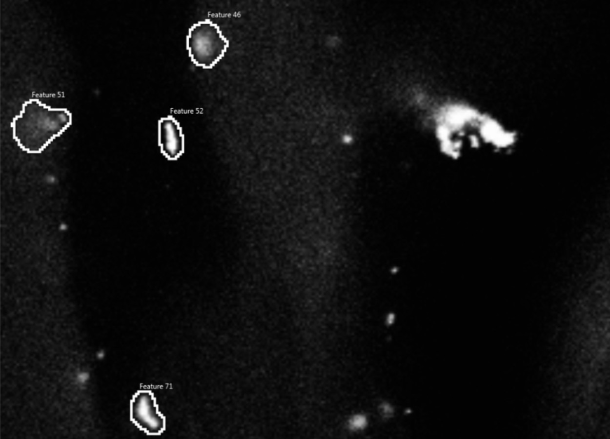 Imagem de microscópio eletrônico de varredura analítica de partículas de nanoplástico marcadas com ouro na raiz de uma planta de trigo - Foto: FELMI-ZFE