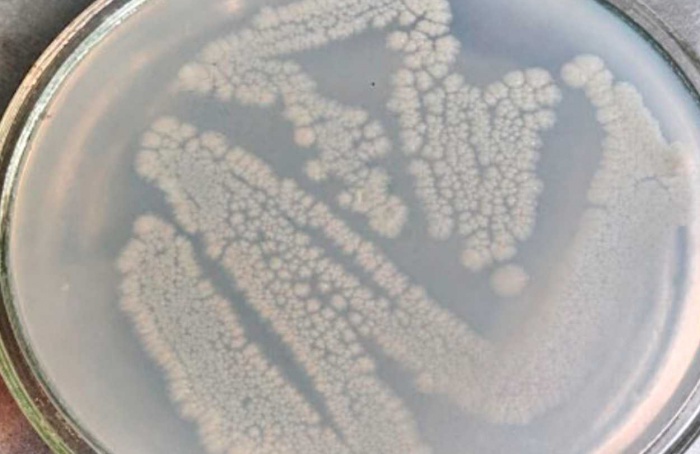 Metabólito de Streptomyces inibe Rhizoctonia solani