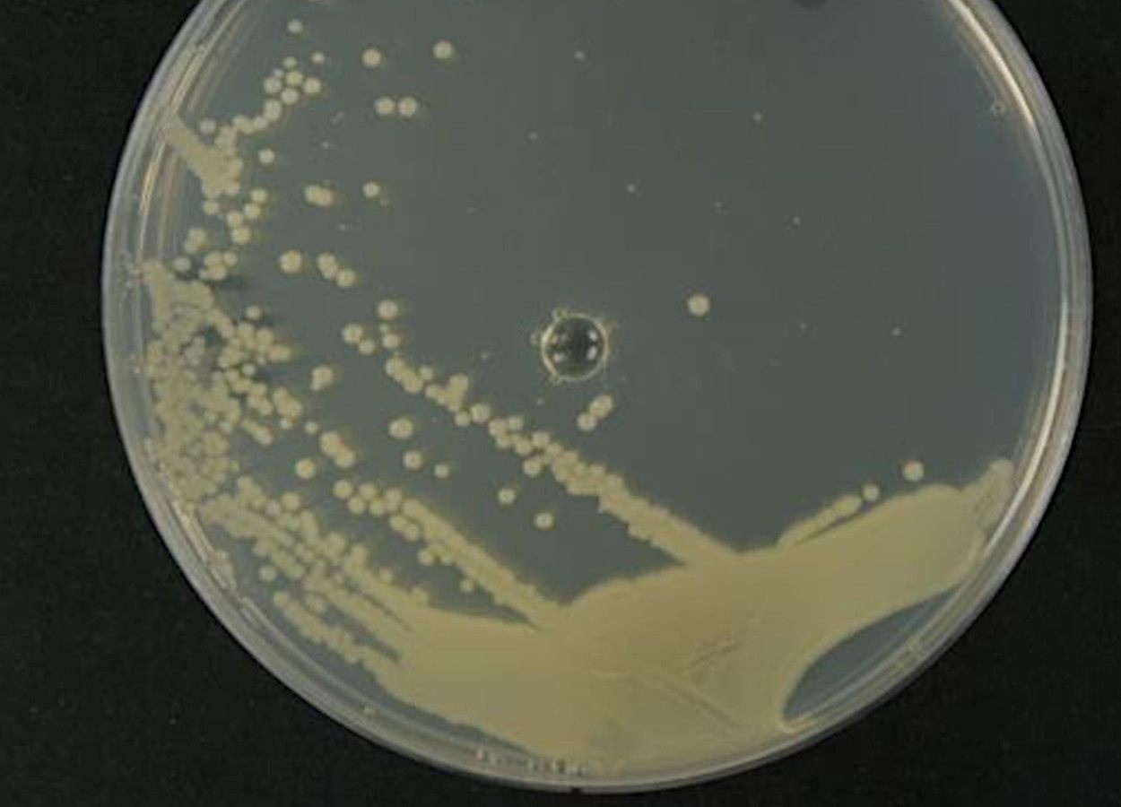 Forschungsergebnisse deuten darauf hin, dass Bacillus safensis Aspergillus flavus hemmt.