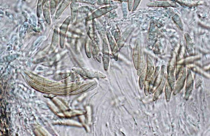 Infecções tardias de canela-preta elevam risco de resistência