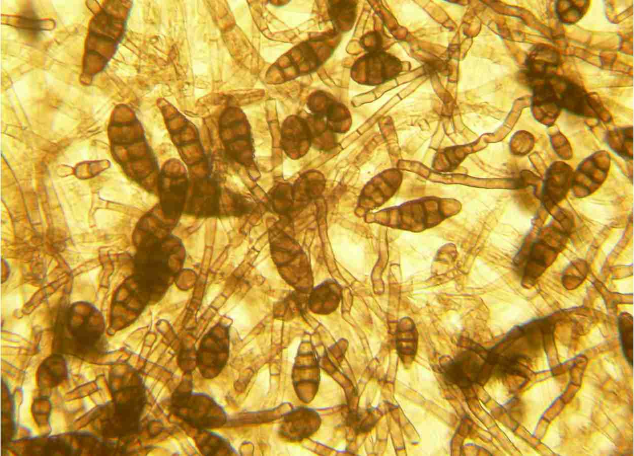 Isolados locais limitaram lesões causadas por Alternaria alternata e Curvularia spicifera em frutos