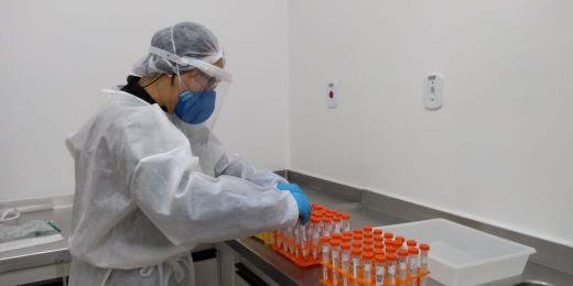 Laboratório do Instituto Biológico inicia diagnóstico para Covid-19