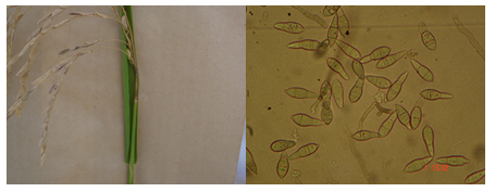 Figura 3: Sintomas de brusone das panículas (esquerda) e conídios de Pyricularia oryzae sob microscópio ótico (direita) Fotos: Fitopatologia UFT