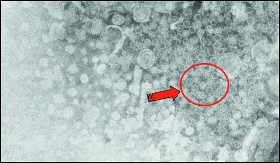 Figura 2 - A) fotomicrografia de partículas do VNBT (um isolado do EMV) observadas no estômago do meloídeo Epicauta atomaria (27.704 x) e B) fotomicrografia eletrônica de partículas do VNBT detectadas nas fezes de E. atomaria (35.208 x).