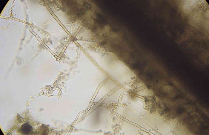 Tifluzamida mostra ação distinta entre grupos de Rhizoctonia
