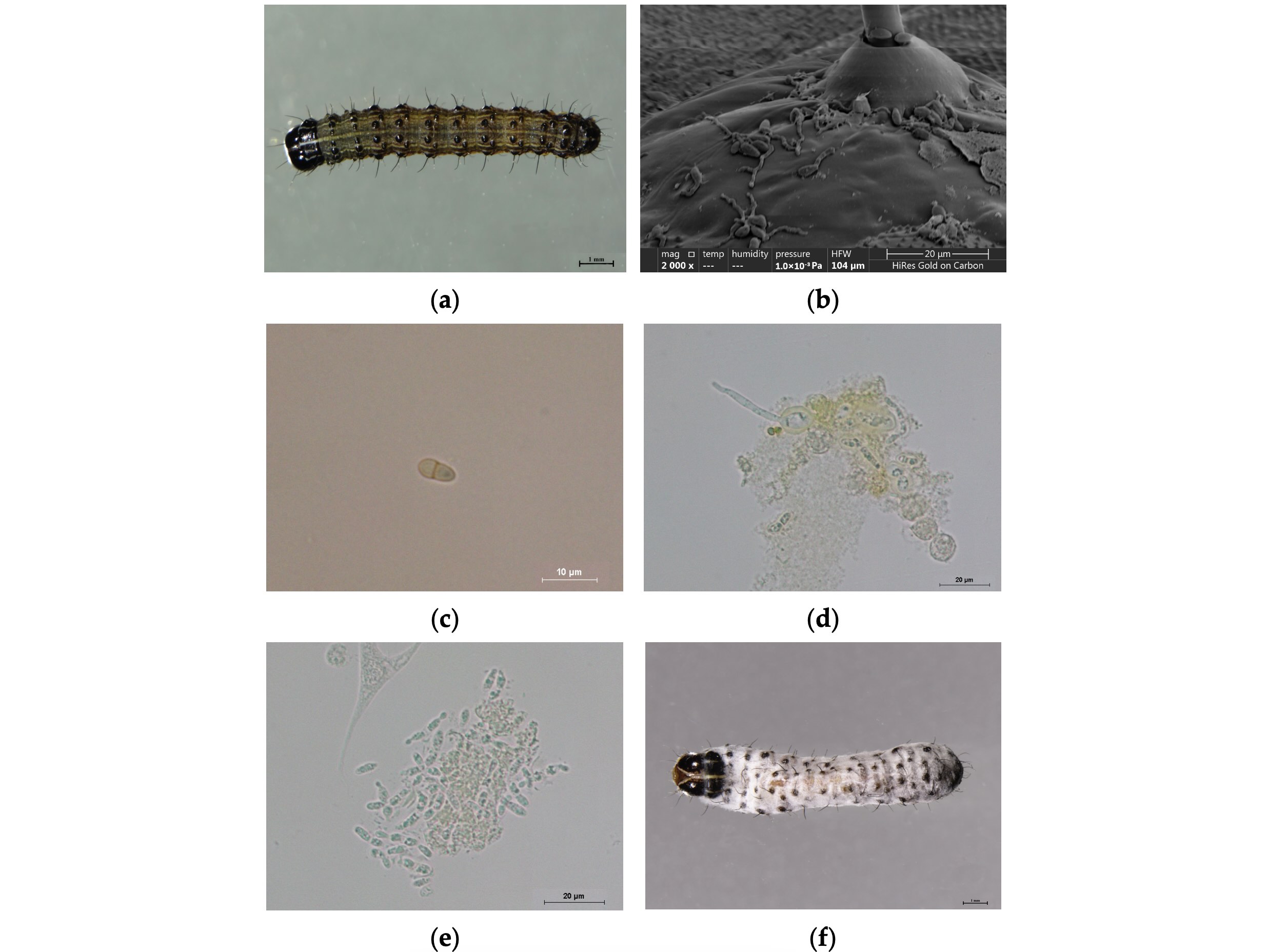 Observação microscópica do processo de infecção da cepa CDTLJ1 em terceira larva de <i>S. frugiperda</i> em <b>(a)</b> 0h pós-infecção (2×), <b>(b)</b> 24h pós-infecção (2000×), <b>(c)</b> 48h pós-infecção (600×), <b>(d)</b> 72h pós-infecção (600×), <b>(e)</b> 96h pós-infecção (600×) e <b>(f)</b> 120h pós-infecção (2×)