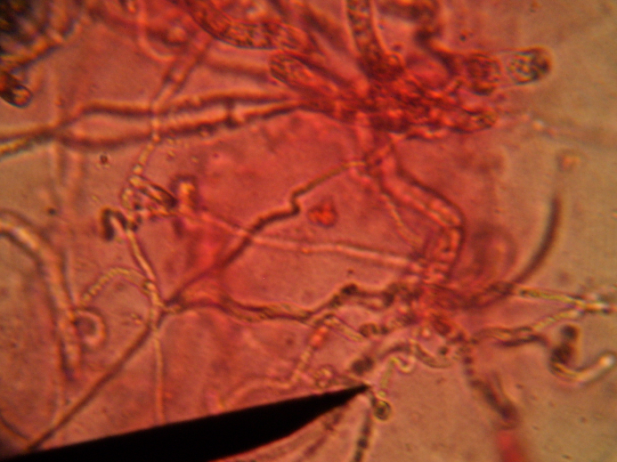 Figura 3 - Microscopia do fungo Fusarium Fonte: os autores, 2013