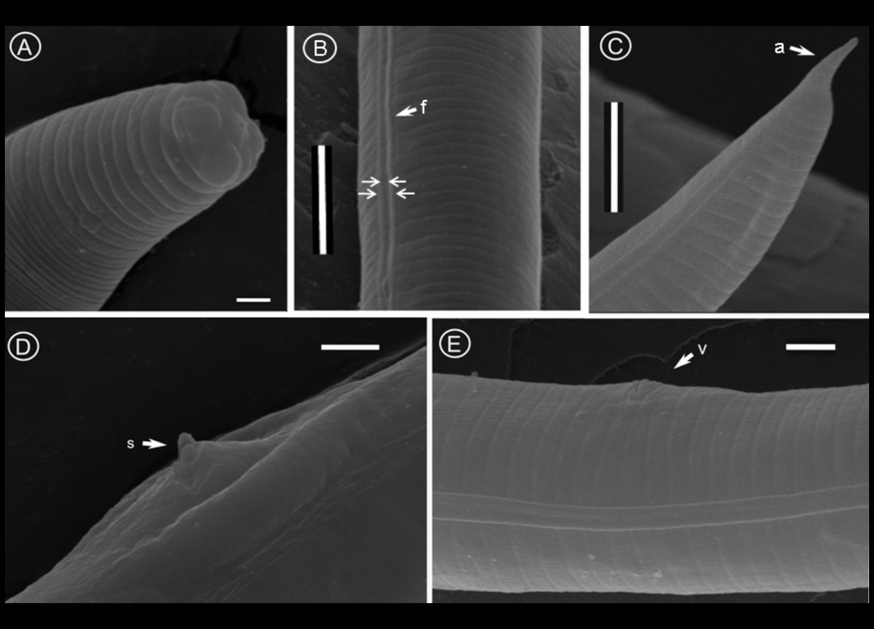 <b>(A)</b> Região labial de uma fêmea semi-obesa; <b>(B)</b> campos laterais, mostrando quatro incisuras (setas); <b>(C)</b>&nbsp;cauda; <b>(D)</b>&nbsp;espículas; <b>(E)</b> vulva. <b>Abreviações:</b> a = apêndice, f = Campo lateral, s = espículas, v = vulva. Barras de escala: A = 1 µm; B, C = 5 µm; D, E = 2 µm.