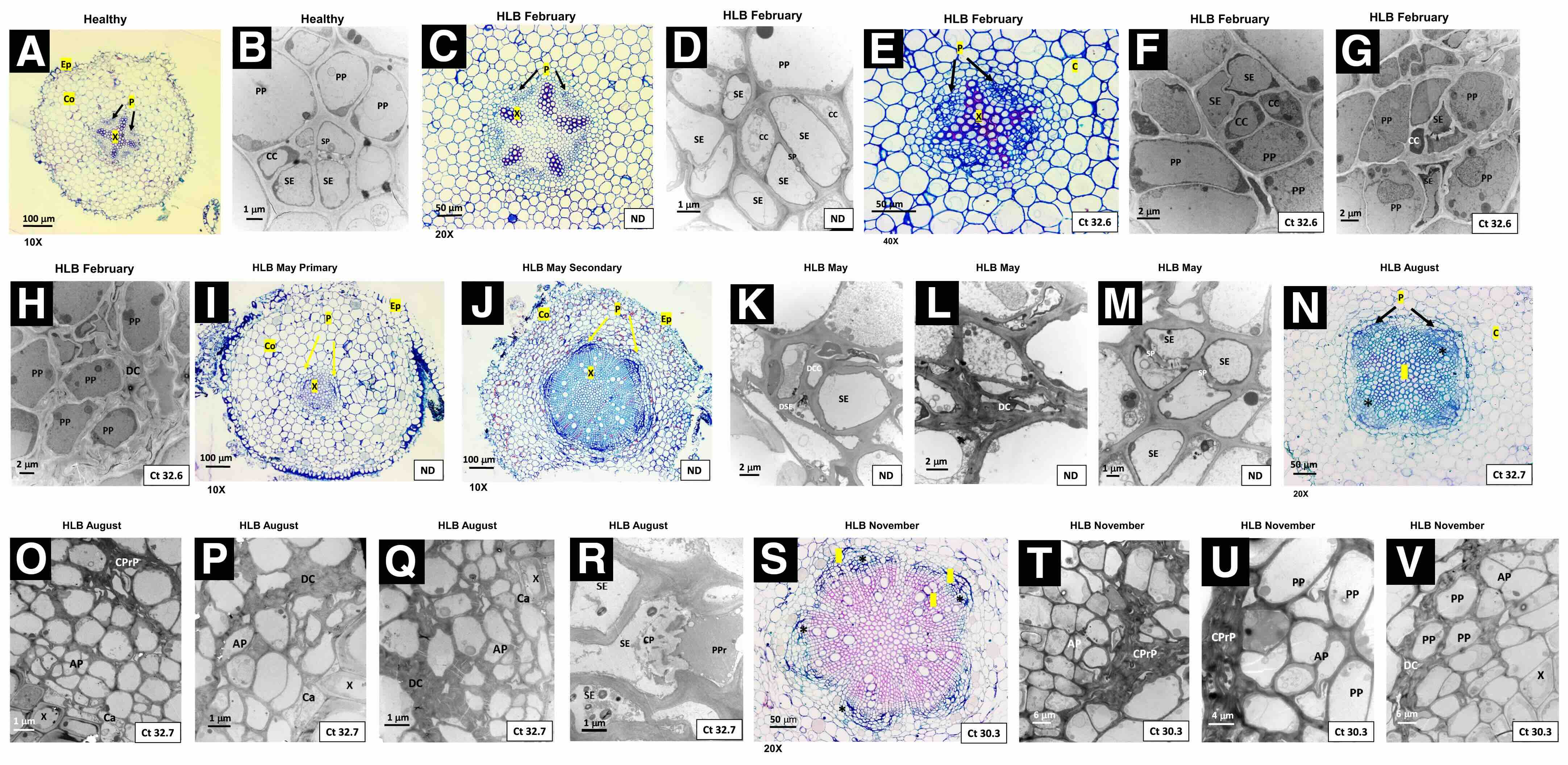 Análises por microscopia de luz e microscopia eletrônica de transmissão (MET) de tecidos radiculares de Citrus sinensis, cultivar Valencia