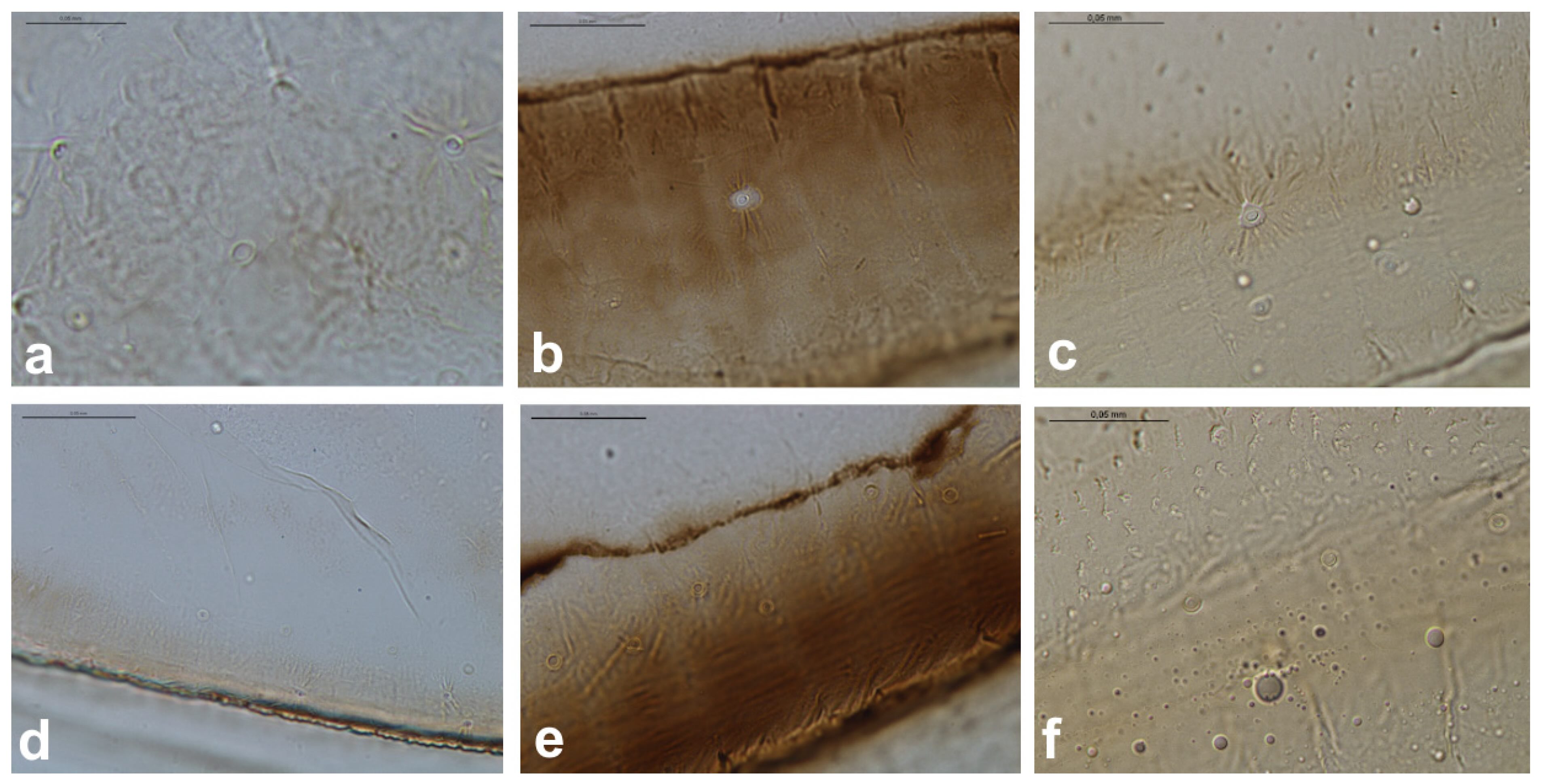 Sensilas campaniformes localizadas na asa anterior de <i>Slavum wertheimae</i> (esquerda), <i>Prociphilus bumeliae</i> (centro) e <i>Pachypappa tremulae</i> (direita) em microscopia óptica ((a–c)—fcs2, (d–f)—fcs3). Barra de escala 0,05 mm -&nbsp;doi.org/10.3390/insects16080828