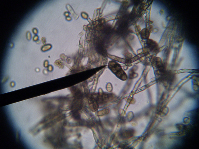 Figura 1 - Microscopia do fungo Alternaria. Fonte: os autores, 2013