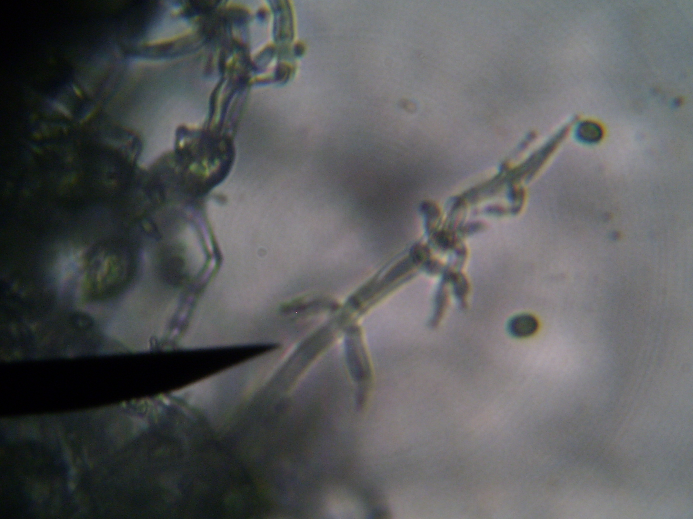 Figura 4 - Microscopia do fungo Penicillium. Fonte: os autores, 2013
