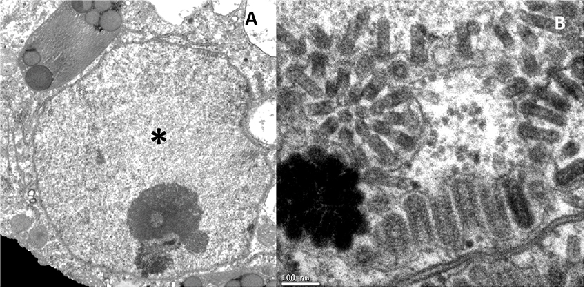 Figura 4 - Micrografia eletrônica de transmissão de uma célula parenquimatosa na lesão foliar em laranjeira causada pelo dichorhavirus citros leprosis virus N (CiLV-N). Em A, núcleo celular com inclusão (viroplasma) mais clara (*), característico da infecção por dichorhavirus. Em B, partículas do CiLV-N (bastonetes curtos), no nucleoplasma, associadas ao invólucro nuclear, e no citoplasma, em contato com membranas do retículo  endoplasmático. 