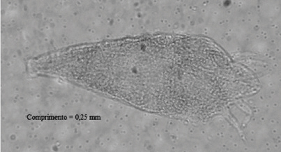 Figura 6 - Oxycenus maxwelli (foto microscópica com aumento de 100x).