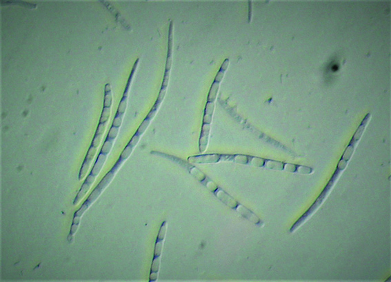 Conídios de Septoria lycopersici.