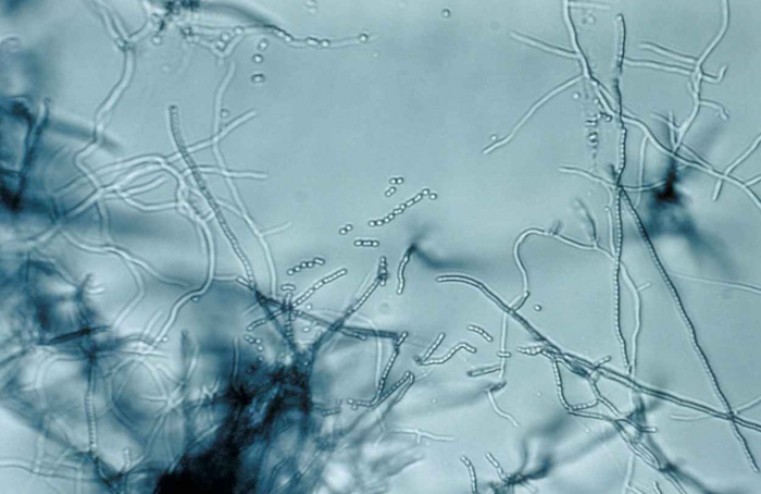 Docosano ajuda no controle de bacterioses em tomate e maçã