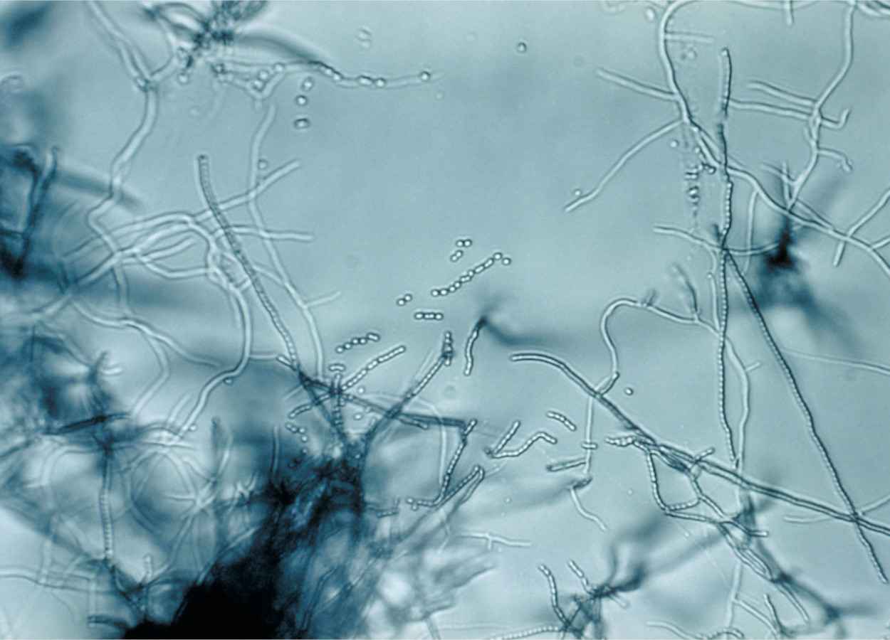 Docosano ajuda no controle de bacterioses em tomate e maçã