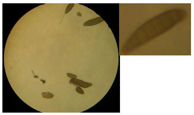 Figura 2 - Microscopia do fungo Bipolaris Fonte: os autores, 2013