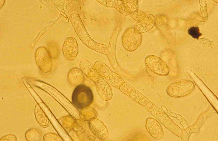 Proteína da parede celular surge como alvo contra oídio em cucurbitáceas