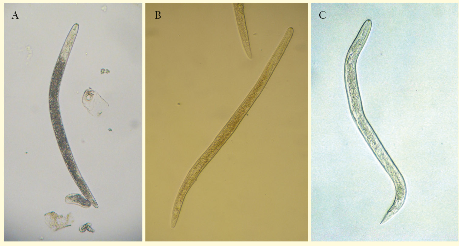Figura 5 - Nematoide-das-lesões-radiculares (Pratylenchus spp.): A - juvenil; B - fêmea e C - macho.