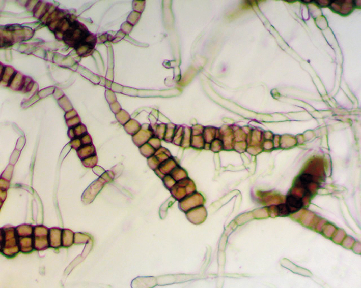 Conídios de Alternaria sp. vistos ao microscópio óptico.