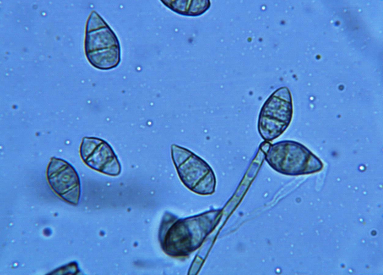 Esporos de Pyricularia oryzae - Foto: Donald Groth -  Louisiana State University AgCenter