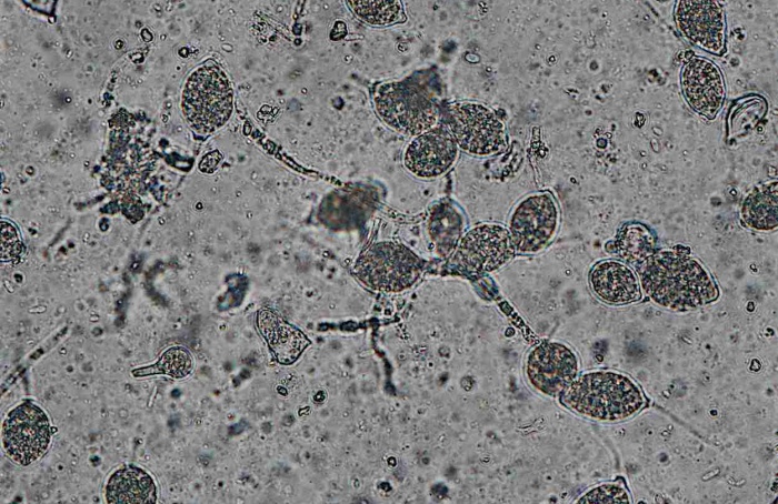 Ácido nonanoico inibe Phytophthora capsici