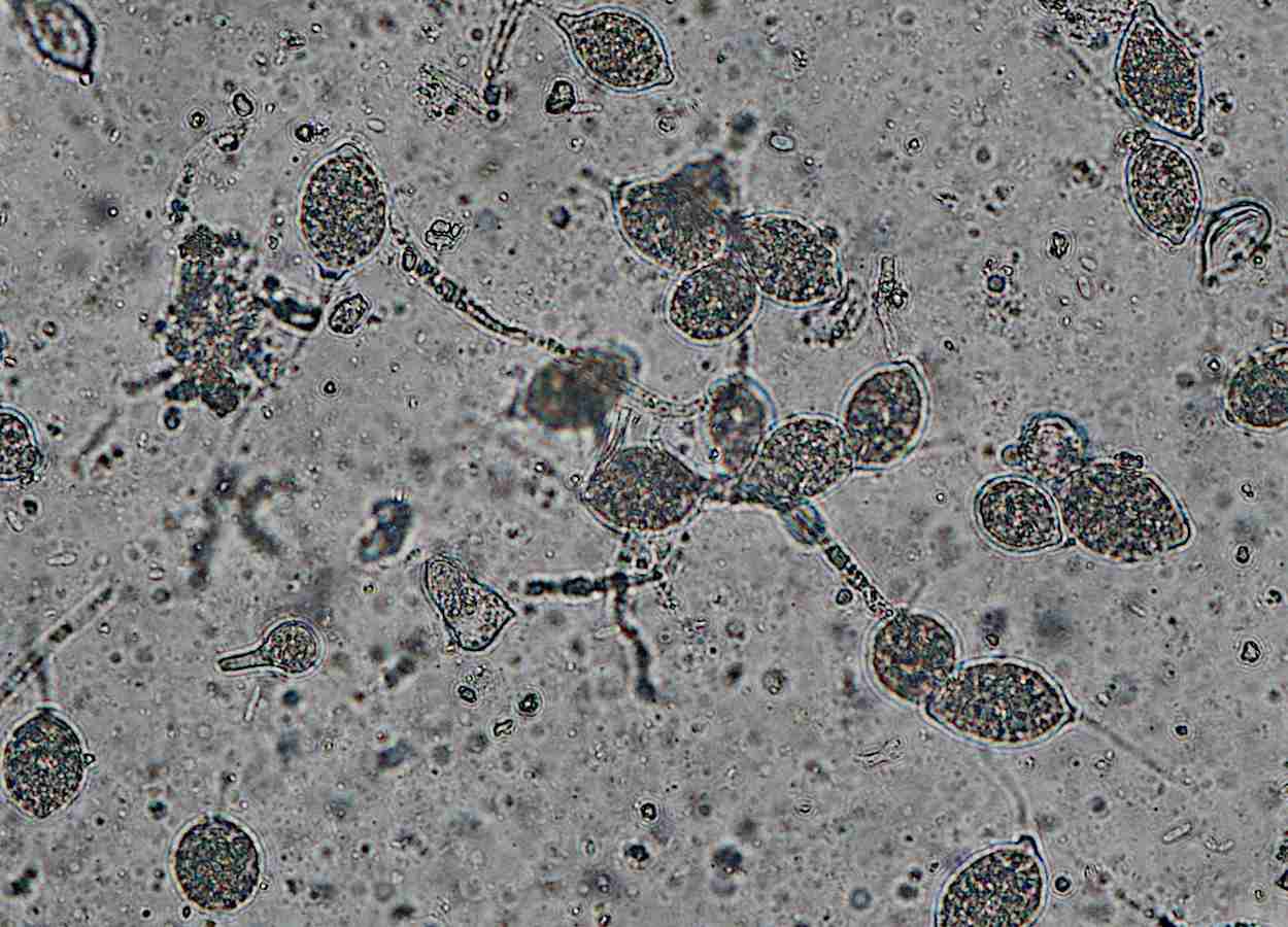 Ácido nonanoico inibe Phytophthora capsici