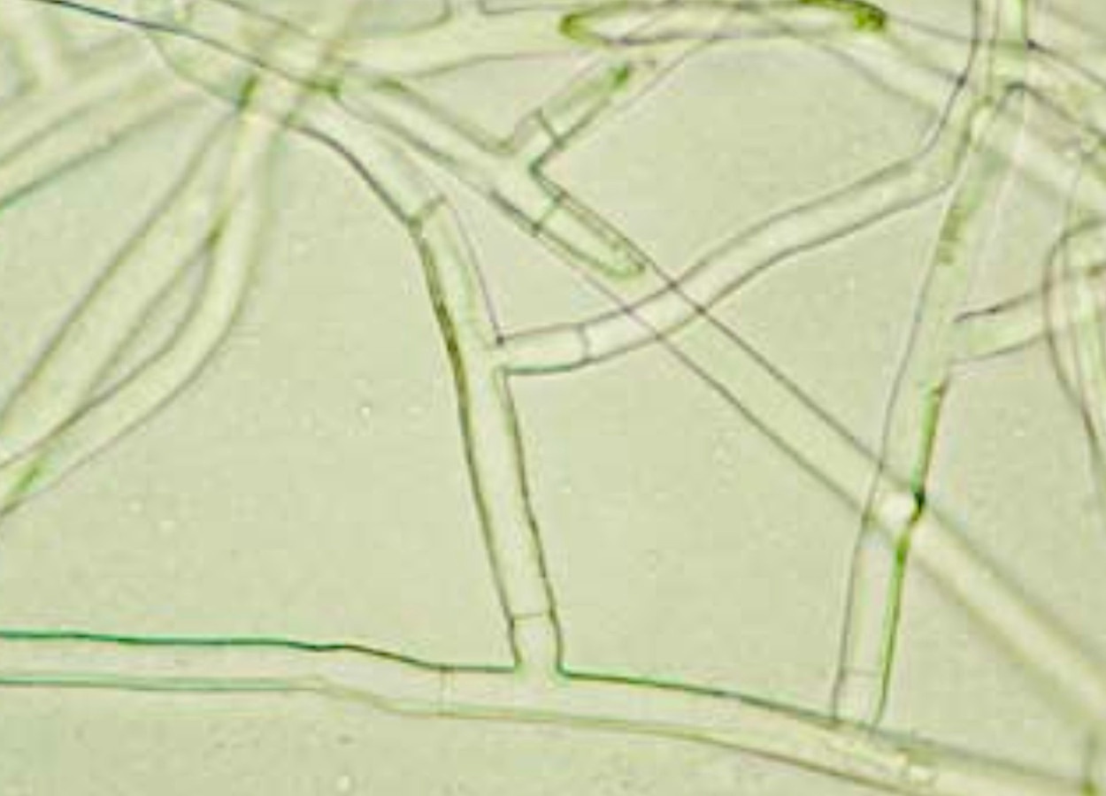 Estudo aponta ação sinérgica com maior eficiência antifúngica e baixa citotoxicidade