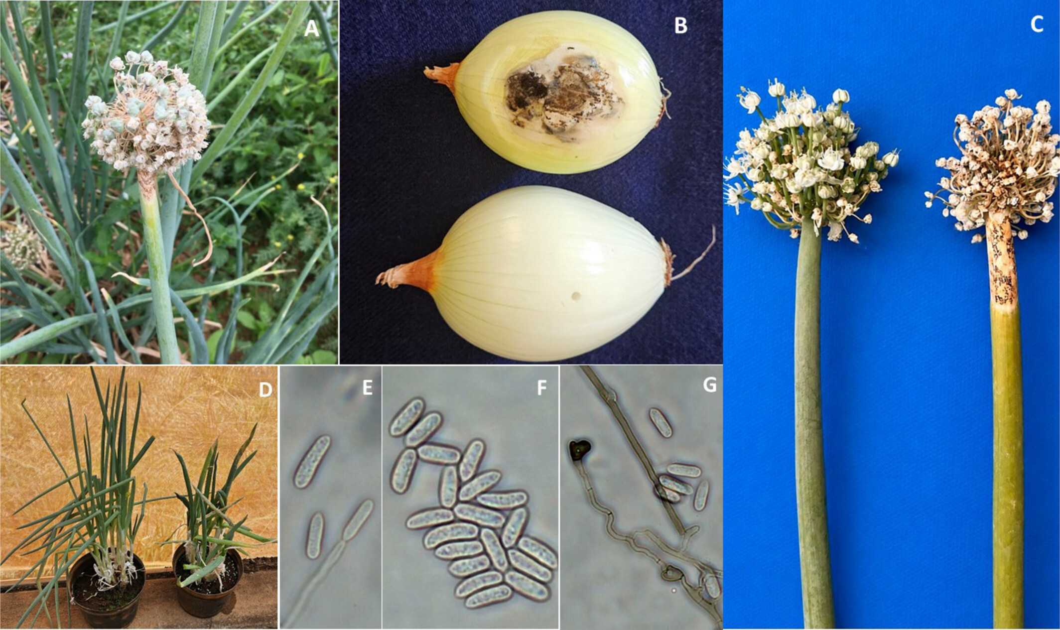 Sintomas de antracnose em haste floral de cebola em condições de campo (A); sintomas em bulbos de cebola inoculados com o isolado Coll 1697 de Colletotrichum (acima) e em um controle não inoculado (abaixo) (B); sintomas em hastes florais de cebola inoculadas com o isolado Coll 1696 (à direita) e em um controle não inoculado (à esquerda) (C); sintomas em folhas de cebola inoculadas com o isolado Coll 1697 (à direita) e em um controle não inoculado (à esquerda) (D); e características morfológicas do patógeno, incluindo conidióforos (E), conídios (F) e apressórios (G) -&nbsp;doi 10.1111/jph.70410