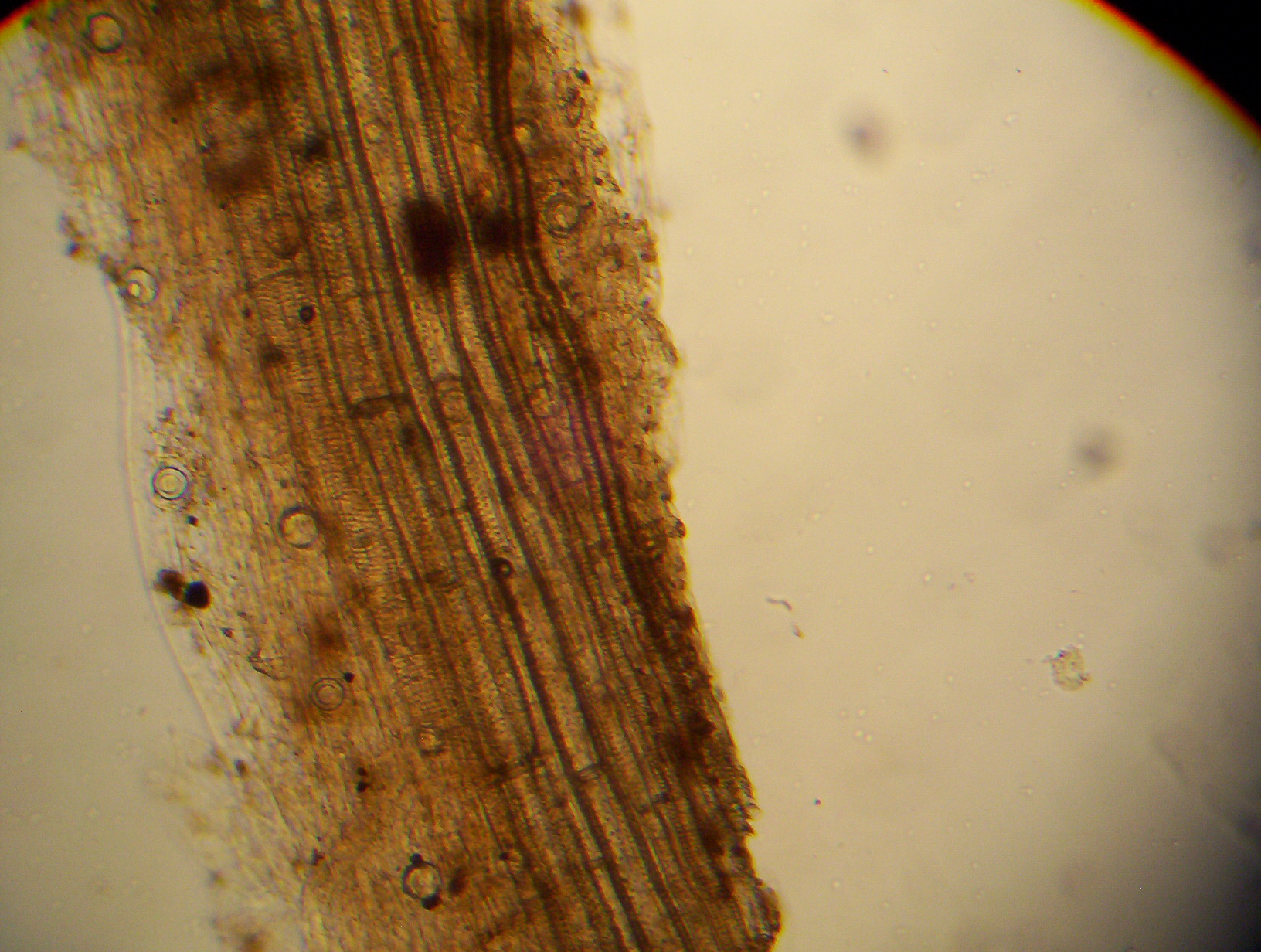 Fig. 4. Oosporos de P. sojae em corte de raiz de soja, como observado em microscópio ótico (aumento de 400 x)