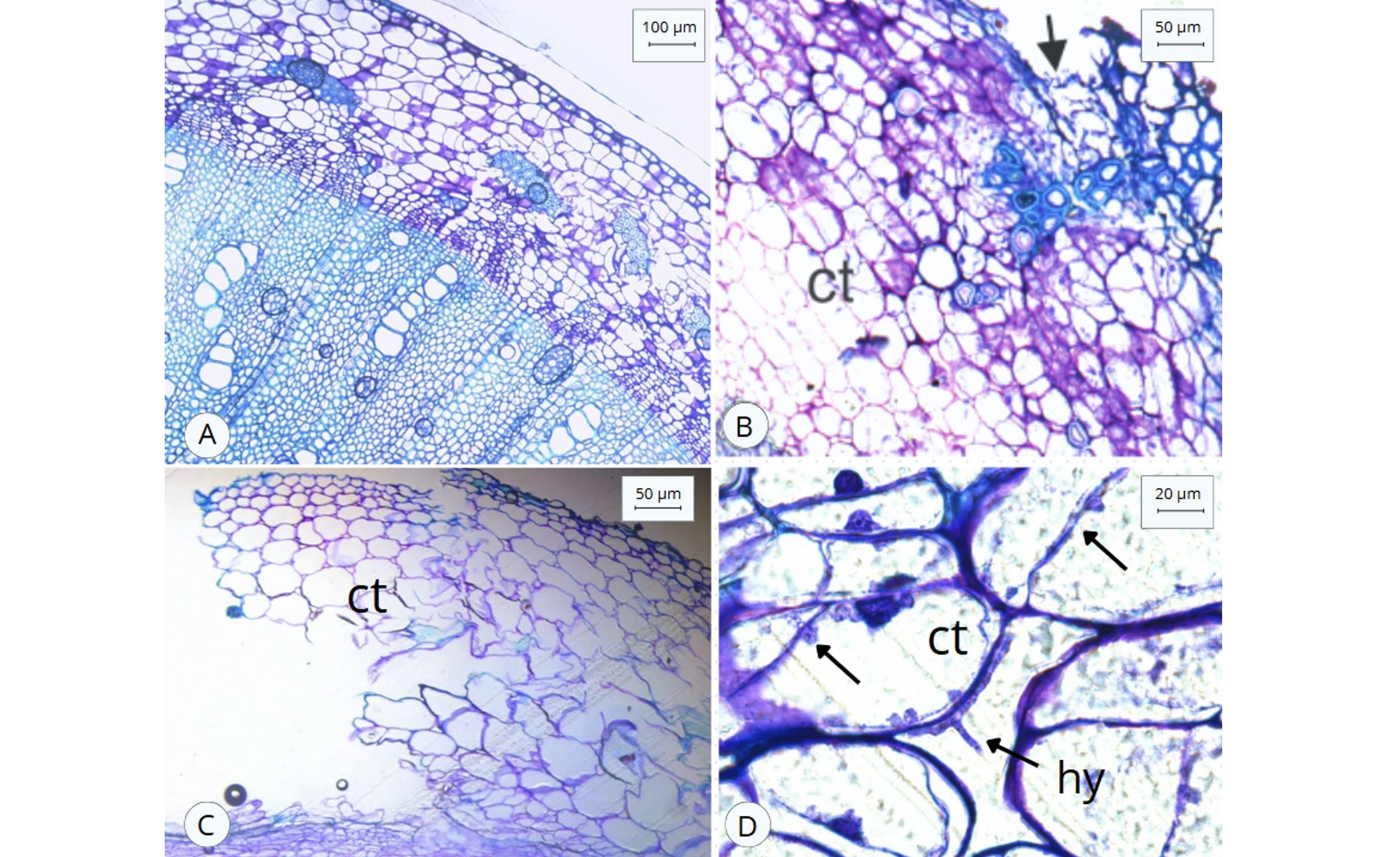 <b>Figura 6 -</b> Haste de plantas de soja em corte transversal, vistas em microscopia óptica, coradas com o corante Azul de Toluidina. A- Caule sem a abertura de fenda, com sua estrutura íntegra. B- Caule na região da fenda, em que se forma um meristema de cicatrização e há o destacamento de tecidos lignificados (indicado pelas setas). C- Região do córtex de plantas afetadas pela “anomalia”, com o rompimento da epiderme, células em hipertrofia e hiperplasia, além de células colapsadas. D- Detalhe do córtex, com a presença de hifas fúngicas nos espaços intercelulares e células plasmolisadas. ct - córtex; hy - hifa.