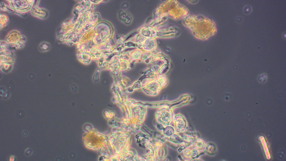 Os microrganismos utilizados na nova planta incluem o fungo "Penicillium coprobium", que é fermentado para produzir o precursor direto do inseticida Inscalis; a imagem mostra as células fúngicas em seu caldo de fermentação